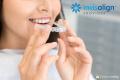 Invisalign