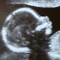 South London & Aylmer Ultrasound Services
