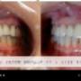 CEREC TECHNOLOGY CEREC TECHNOLOGY