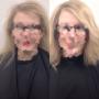 Hair piece system for hereditary hair loss Vancouv Hair piece system for hereditary hair loss Vancouv