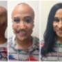 Hair piece & wig solutions for alopecia Vancouver Hair piece & wig solutions for alopecia Vancouver