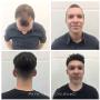 Male undercut with hair piece Pacific Vancouver Male undercut with hair piece Pacific Vancouver