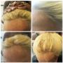 Undetectable hair line for lace front wig Undetectable hair line for lace front wig