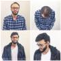 male lace front hair piece Pacific Hair Vancouver male lace front hair piece Pacific Hair Vancouver