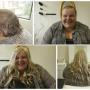 Trichotillomania lace front wig solution Trichotillomania lace front wig solution