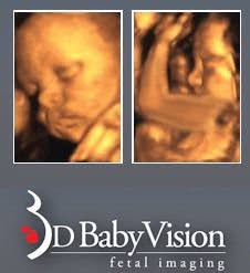 3D BabyVision