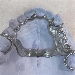 Custom Dental Technologies