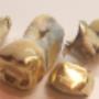 Dental Gold, Calgary Gold Buyer Dental Gold, Calgary Gold Buyer