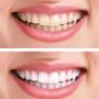 Danforth Dentistry - whitening Danforth Dentistry - whitening