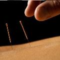 Acupuncture