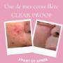 Ligne Clear Proof cette ligne est conçu pour ciblé les clients qui ont problème acné légère a modéré Ligne Clear Proof cette ligne est conçu pour ciblé les clients qui ont problème acné légère a modéré