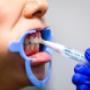 Brushed on each tooth individually, your gums are not in contact with the hydrogen peroxide like they are with strips and take home trays. Brushed on each tooth individually, your gums are not in contact with the hydrogen peroxide like they are with strips and take home trays.