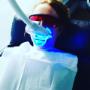 Actual DaVinci Teeth Whitening Sault Ste. Marie client during the laser whitening process. Actual DaVinci Teeth Whitening Sault Ste. Marie client during the laser whitening process.