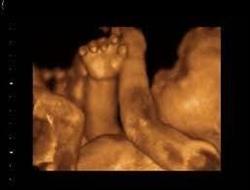 3D BabyVision 3D Ultrasound Mississauga (Square One)
