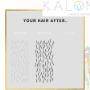 Laser Hair Removal Calgary - Kalon Medical Aesthetics Laser Hair Removal Calgary - Kalon Medical Aesthetics