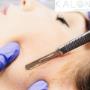 Dermaplaning Treatment - Kalon Medical Aesthetics Dermaplaning Treatment - Kalon Medical Aesthetics
