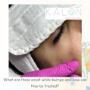 Skin Treatment - Kalon Medical Aesthetics Skin Treatment - Kalon Medical Aesthetics