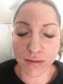 Oxygen-facial