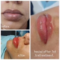 Dermatec Skin Care & Laser Clinic