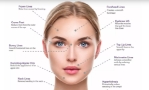 Botox treatment at Totally Botox in Calgary Botox treatment at Totally Botox in Calgary